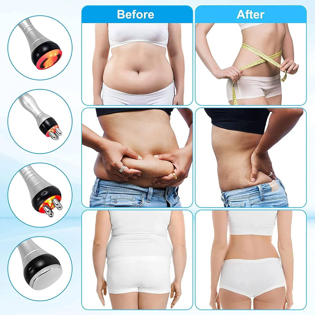 LUMISCULPT 3-in-1 Smart Lipo-Cavitation Device